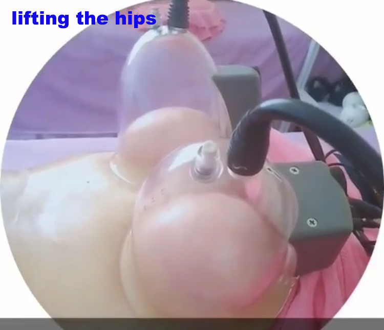 Cheap Price Butt Enlargement Equipment Cup Vacuum Therapy Cupping Machine For Buttocks Enlargement