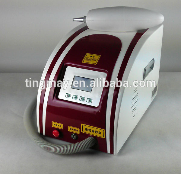 Qswitch nd yag laser tattoo removal system