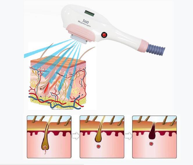 360 magneto optical OPT hair removal machine