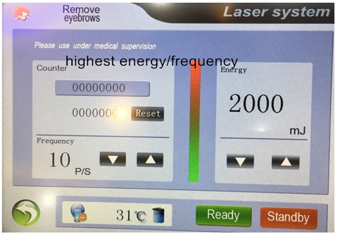 New product big screen 2000mj 532nm 1064nm 1320nm nd yag laser tattoo removal laser machine