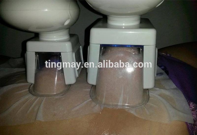 Professional 4 hand pieces fat freeze portable cryo fat reducing machine